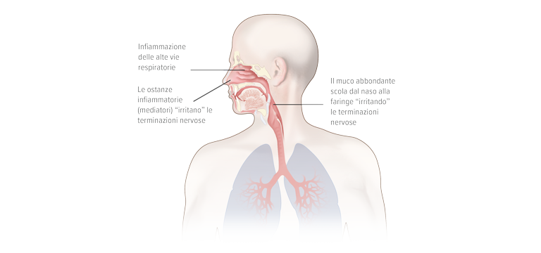 Fattori scatenanti la tosse nelle infezioni delle alte vie respiratorie - Apoteca Natura