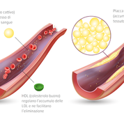 Ipercolesterolemia - Apoteca Natura