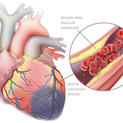 Aterosclerosi - Apoteca Natura