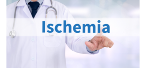 Ischemia - Apoteca Natura