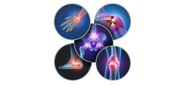 Le patologie osteoarticolari - Apoteca Natura