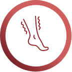 Sindrome delle gambe senza riposo